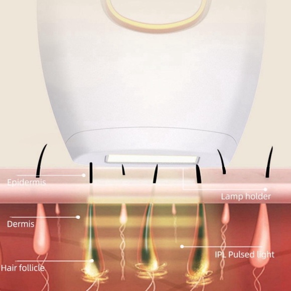 Lyne IPL Hair Removal Laser Comfort Permanent Device for All Parts of the Body - Picture 5 of 8